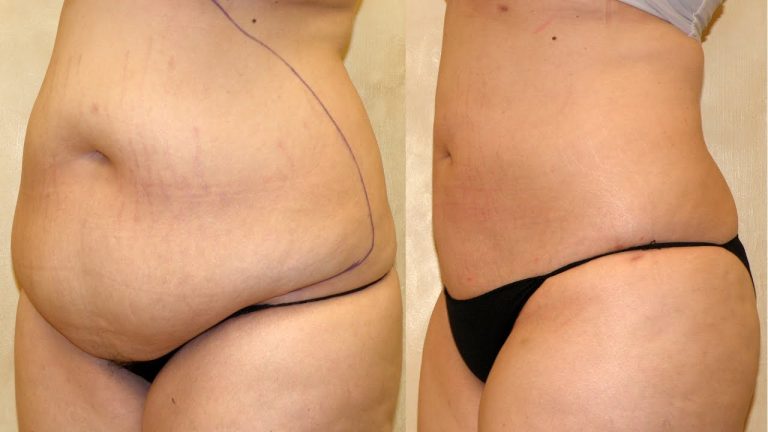 cosmetic surgery