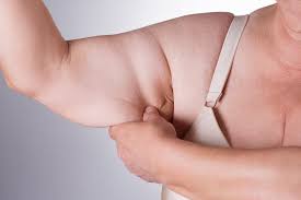 lipo arm fat