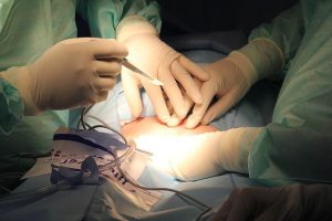 operation